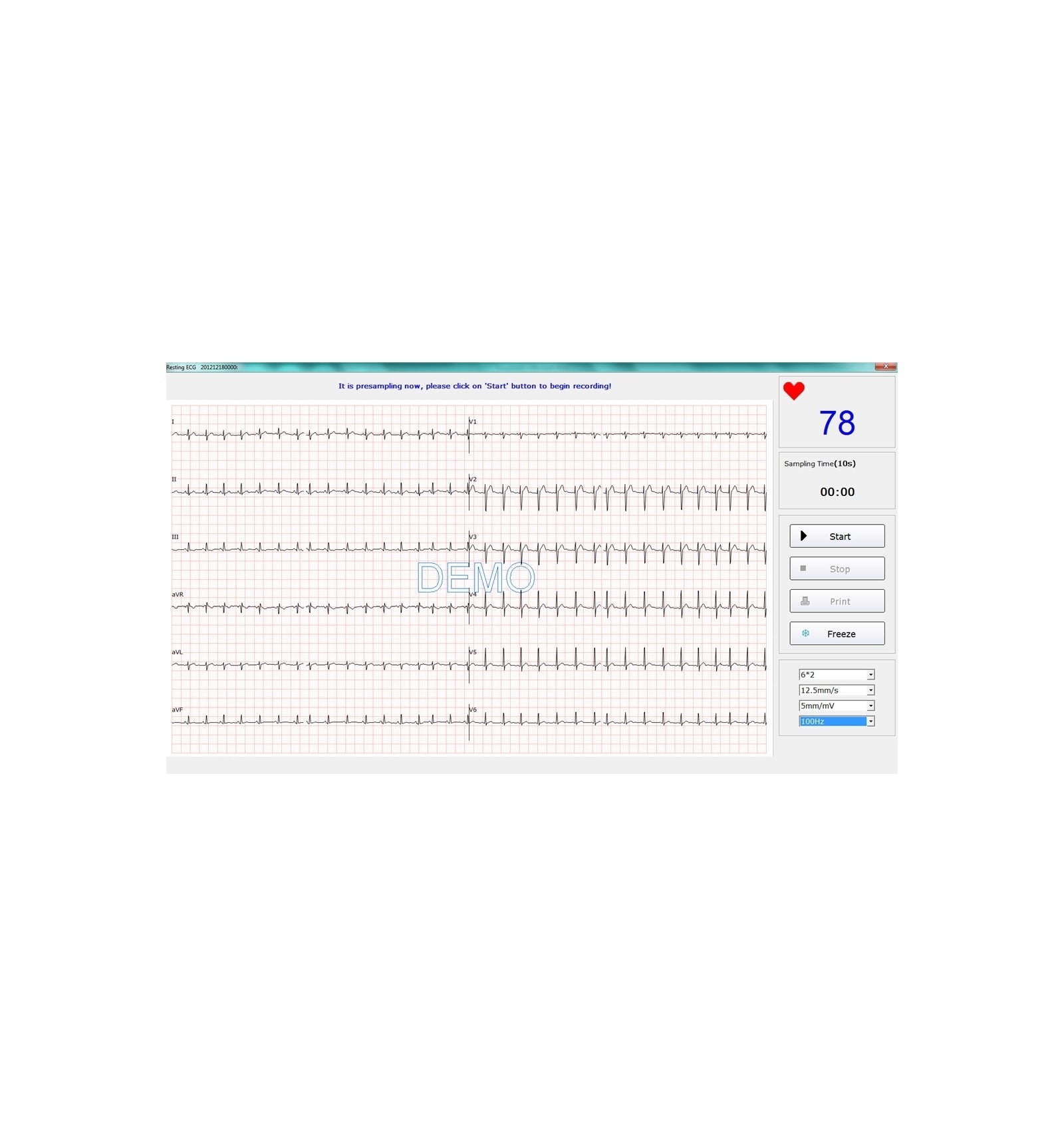 ECG PC Numérique SE-1010 Edan