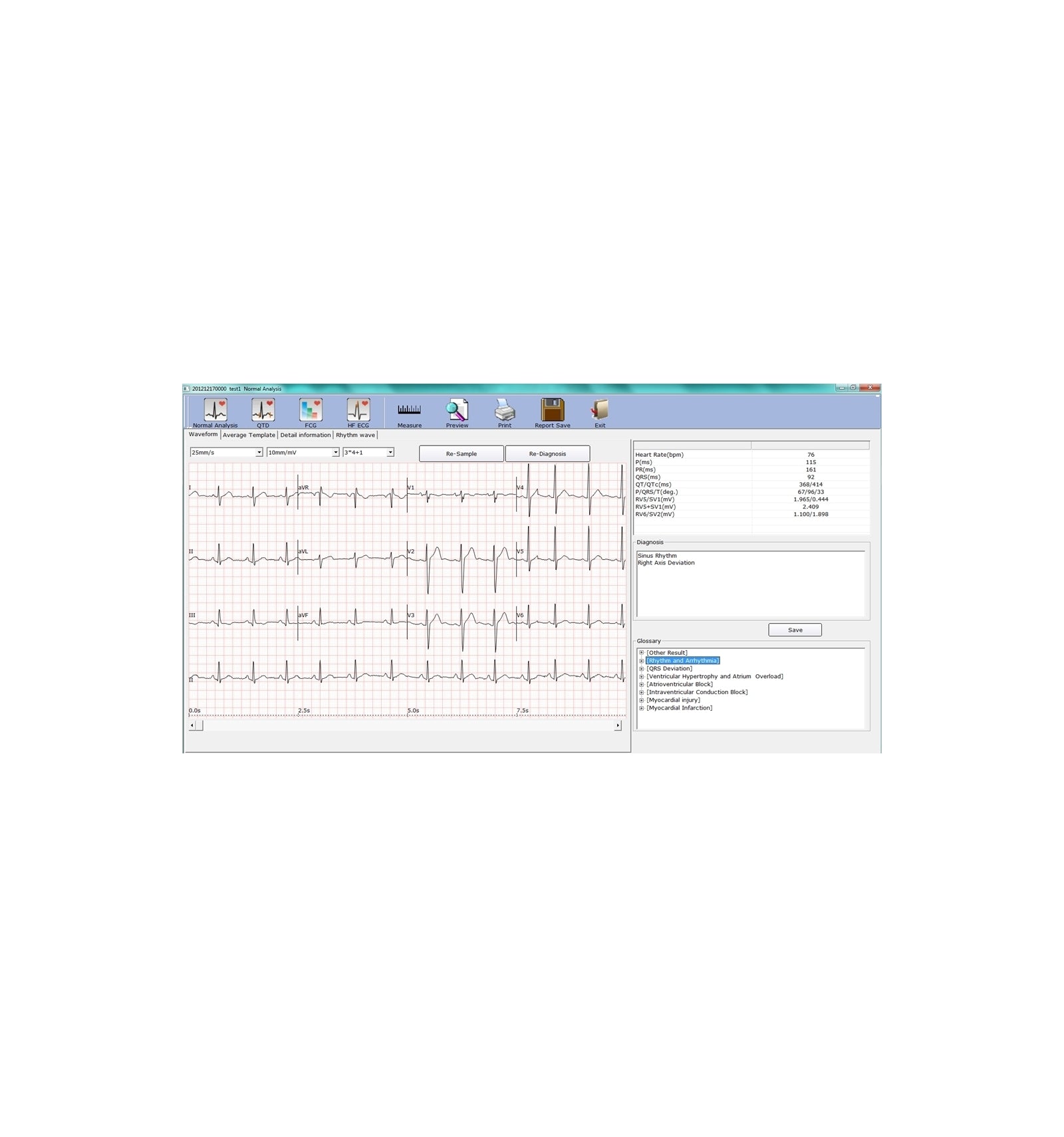 ECG PC Numérique SE-1010 Edan
