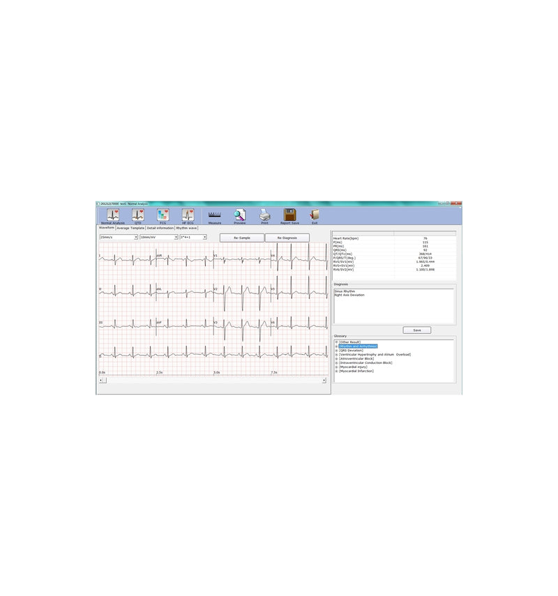 ECG PC Numérique SE-1010 Edan