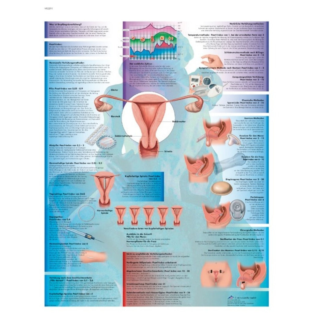 Planche anatomique Contraception - 3B Scientific