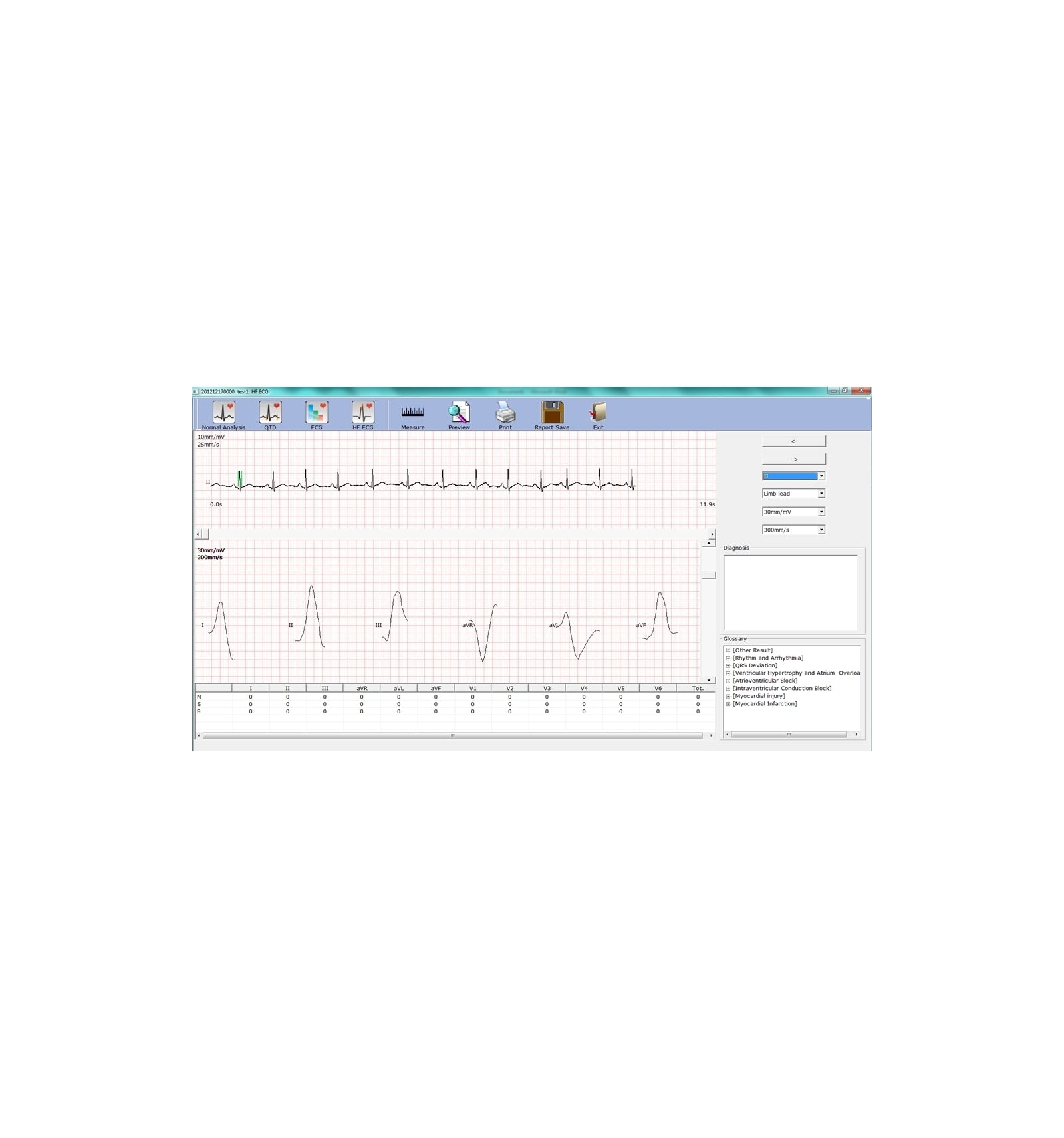 ECG PC Numérique SE-1010 Edan
