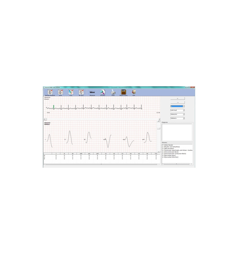 ECG PC Numérique SE-1010 Edan