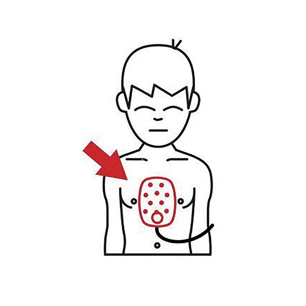 Cartouche d’électrodes Smart pédiatrique/enfant HS1 - Philips