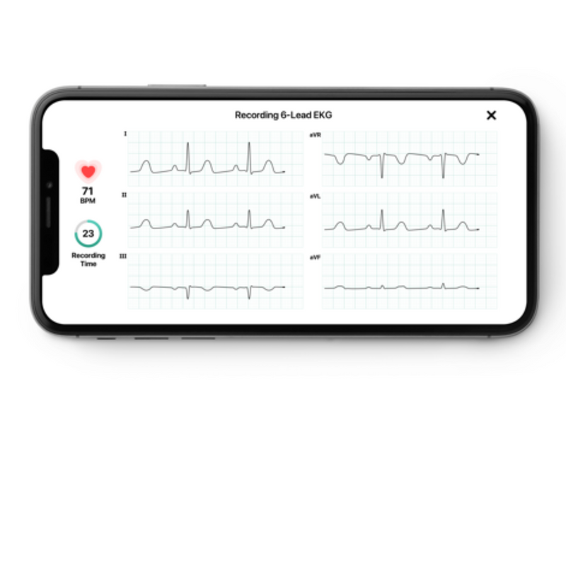 Electrocardiographe ECG KardiaMobile - Omron