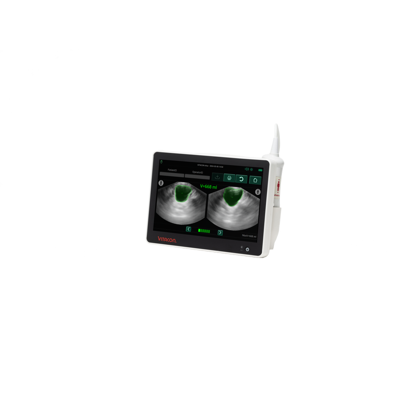 Bladder scanner VitaScan