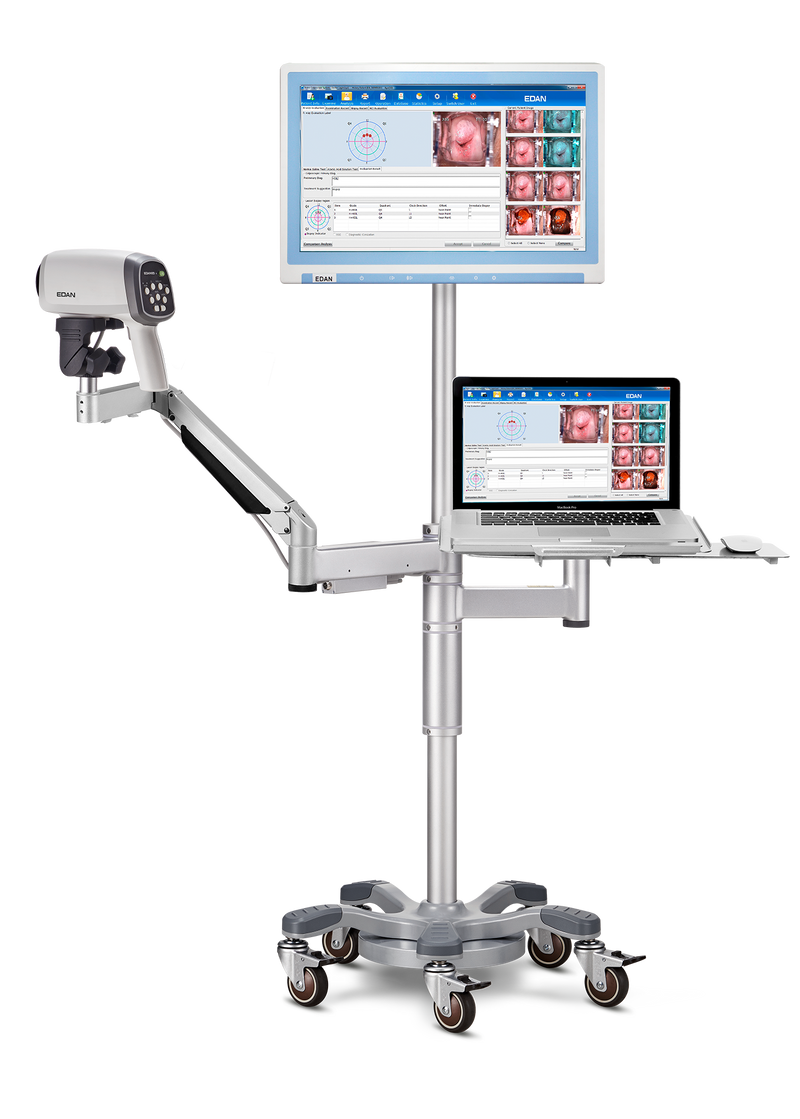 Videocolposcoop C6A-EDAN