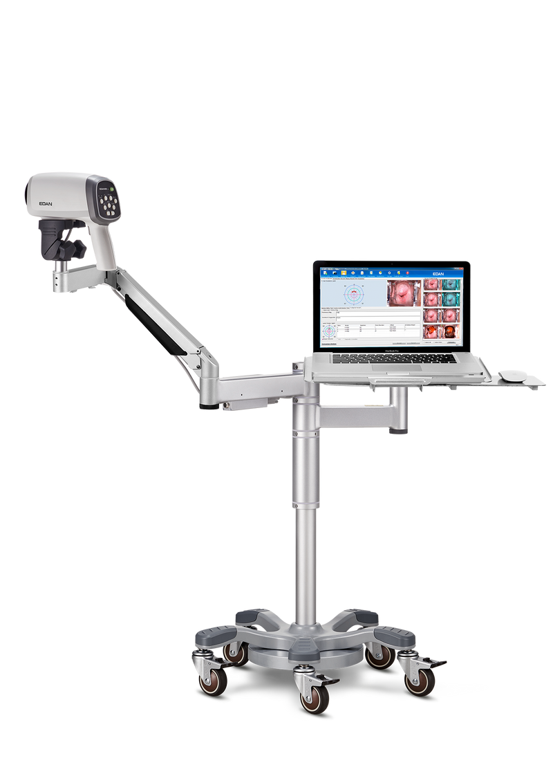 Videocolposcoop C6A-EDAN