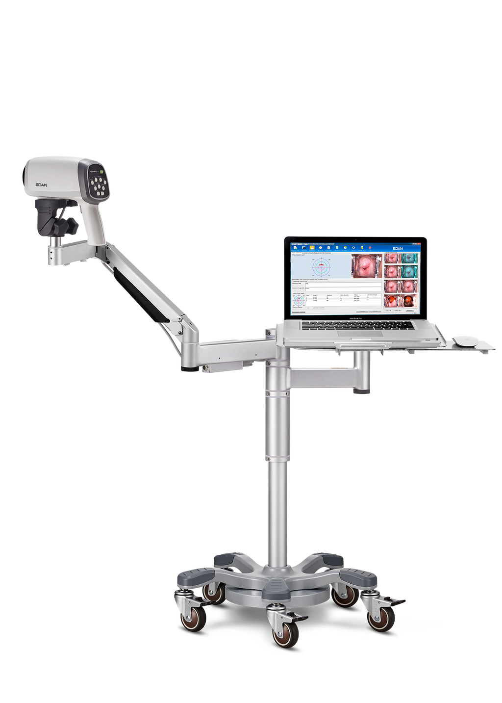 Videocolposcoop C6A-EDAN