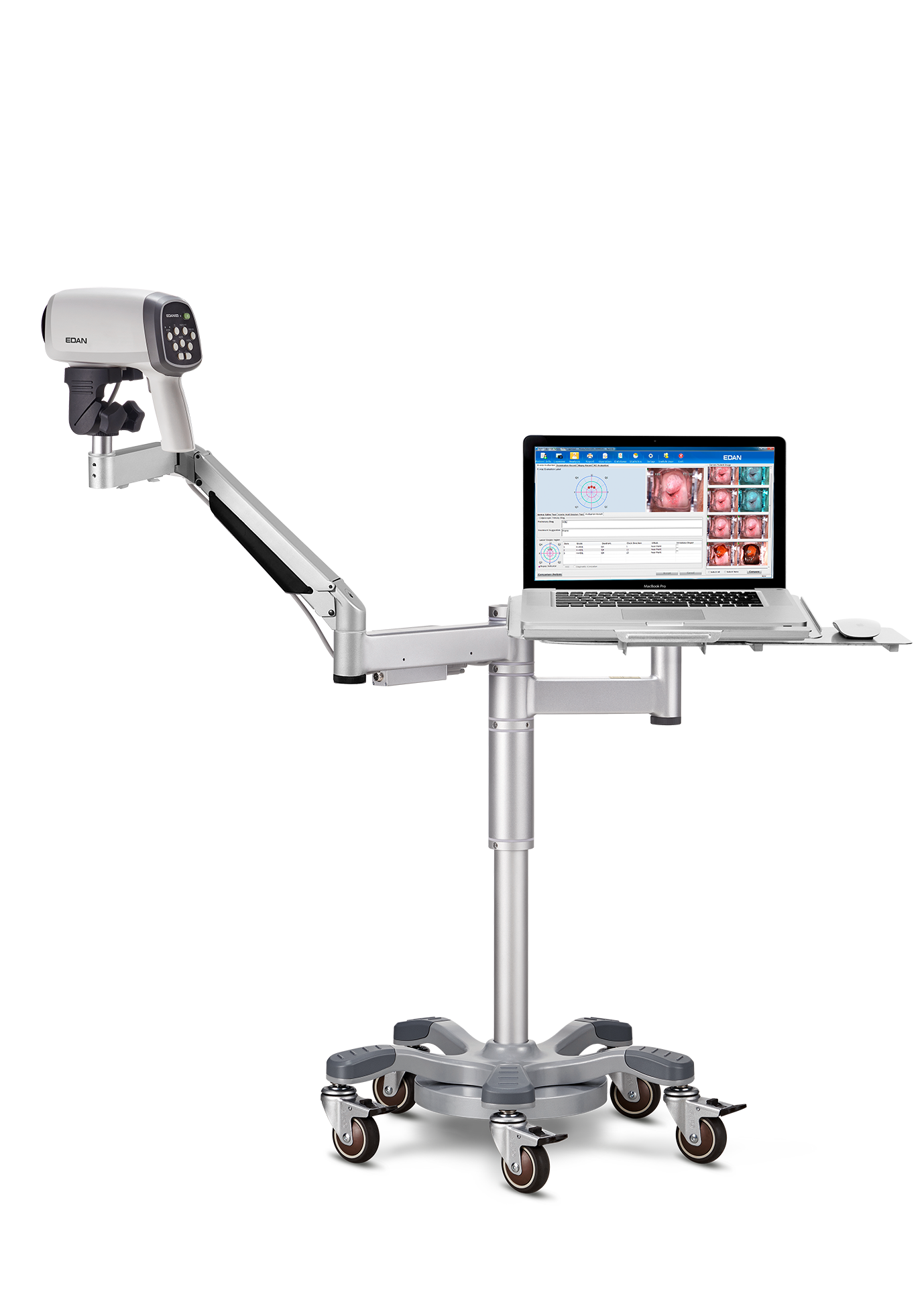 Videocolposcoop C6A-EDAN