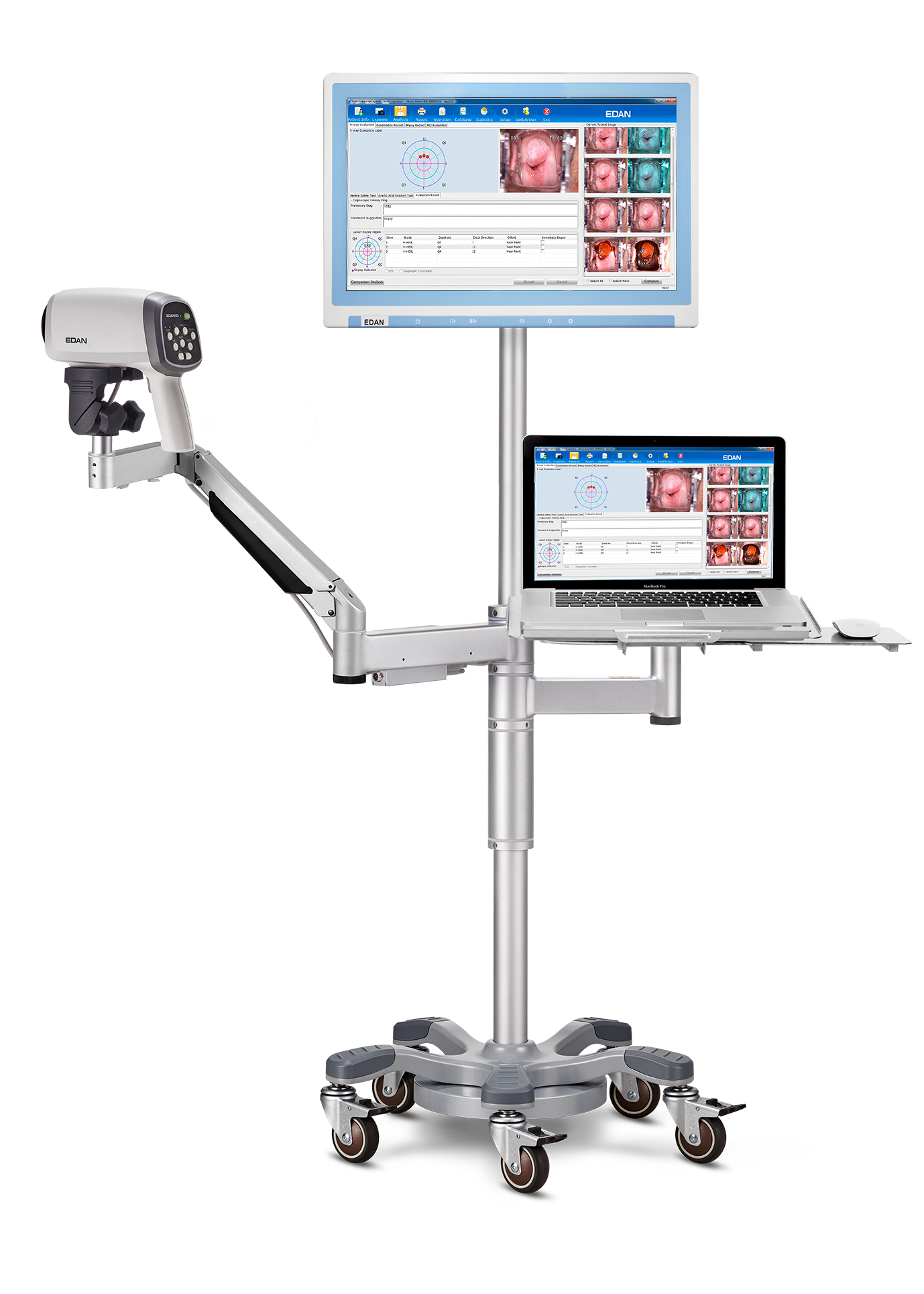 Videocolposcoop C6A-EDAN