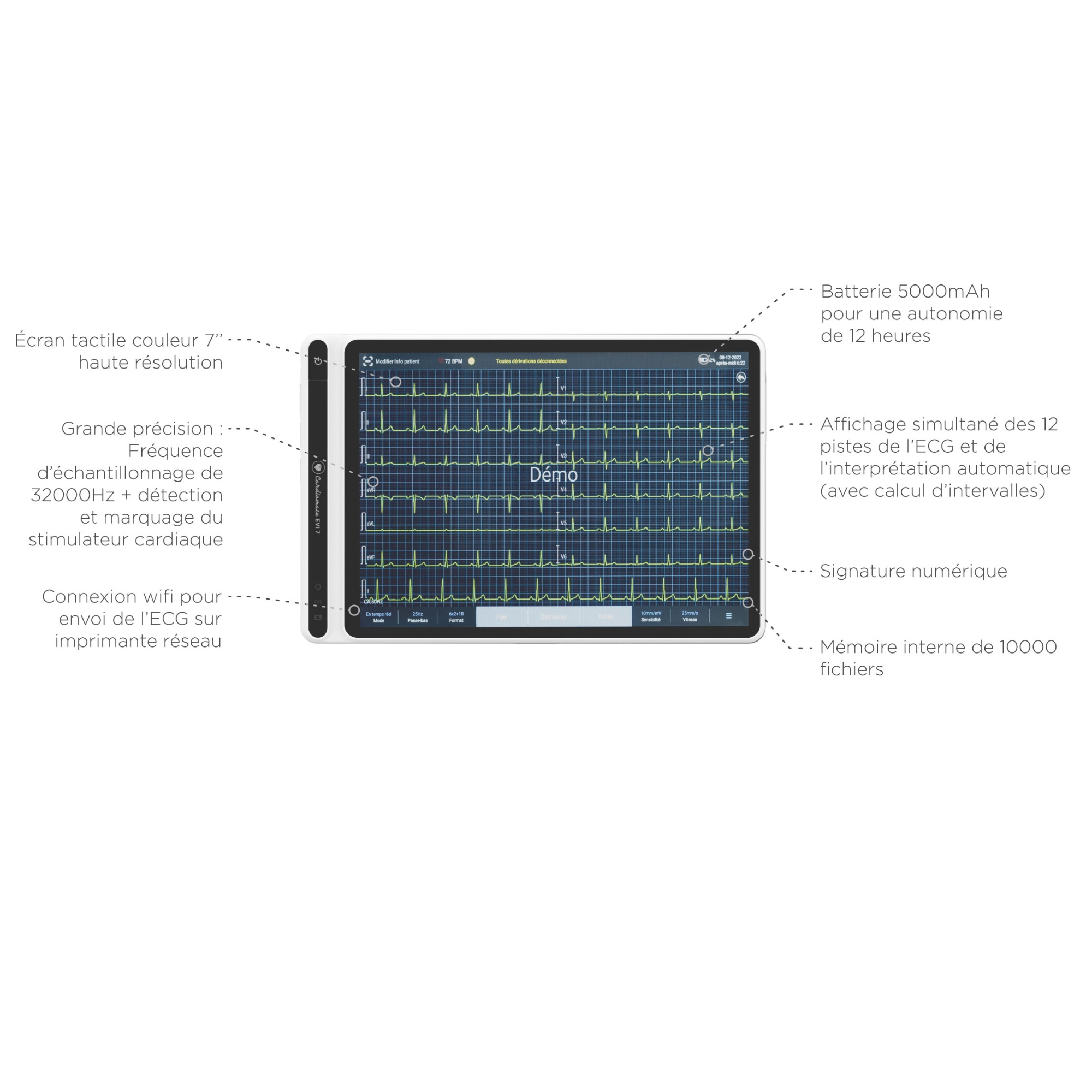 Tablette ECG portable 12 pistes EVI 7 Cardiomate Spengler