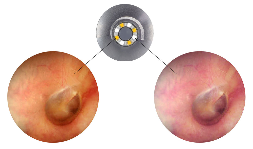 Otoscope LuxaScope Auris CCT LED 2.5V - Noir