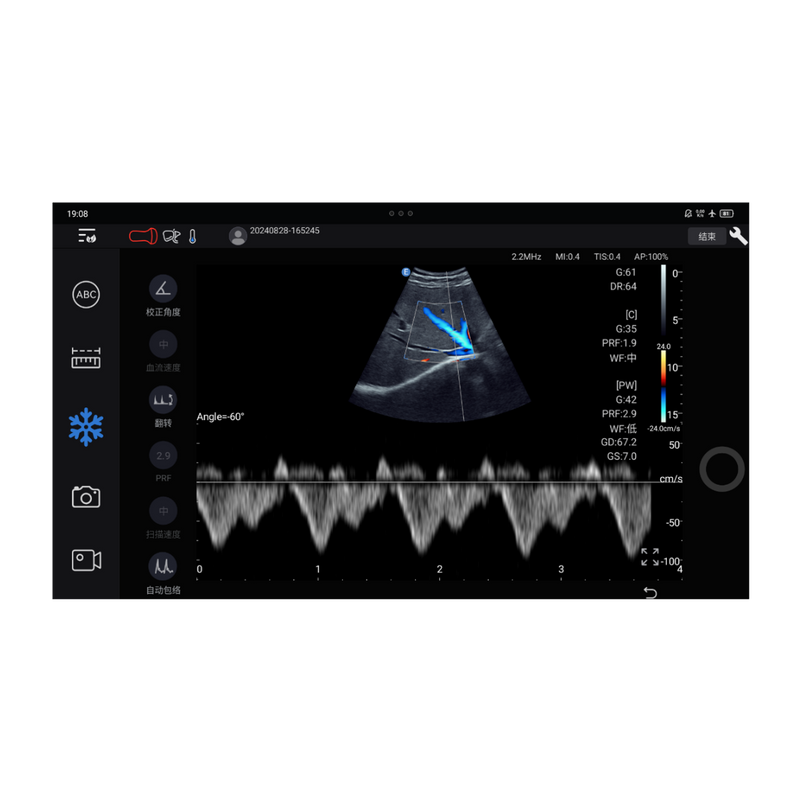Echographe couleur portable Edan Nano convexe