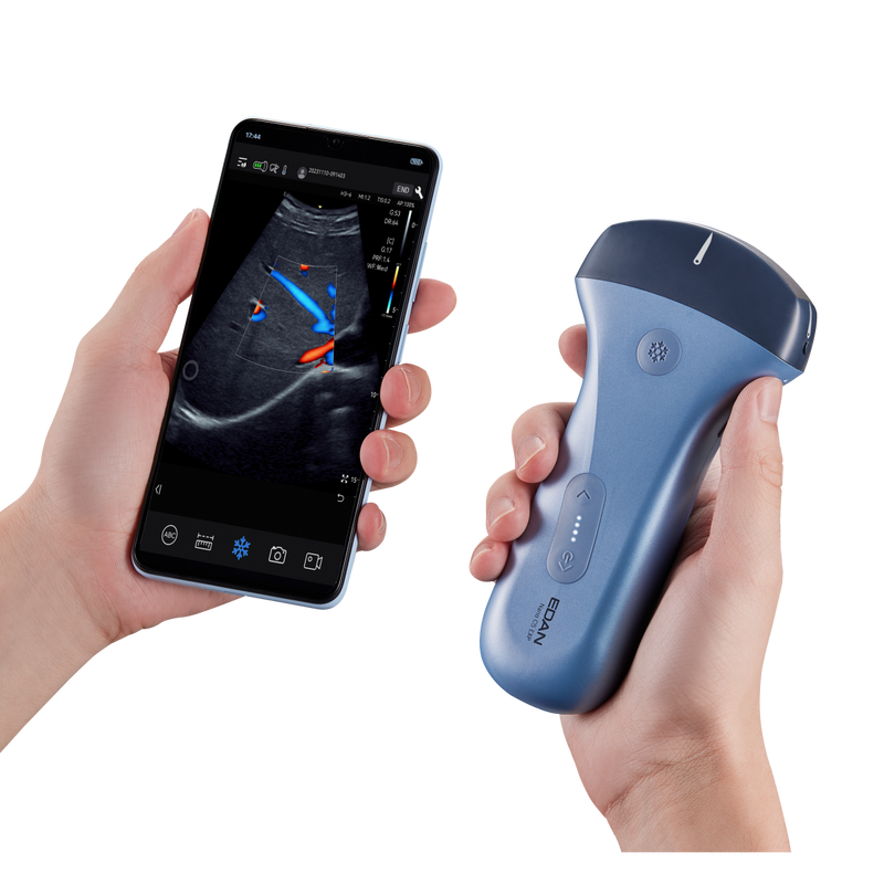 Echographe couleur portable Edan Nano convexe