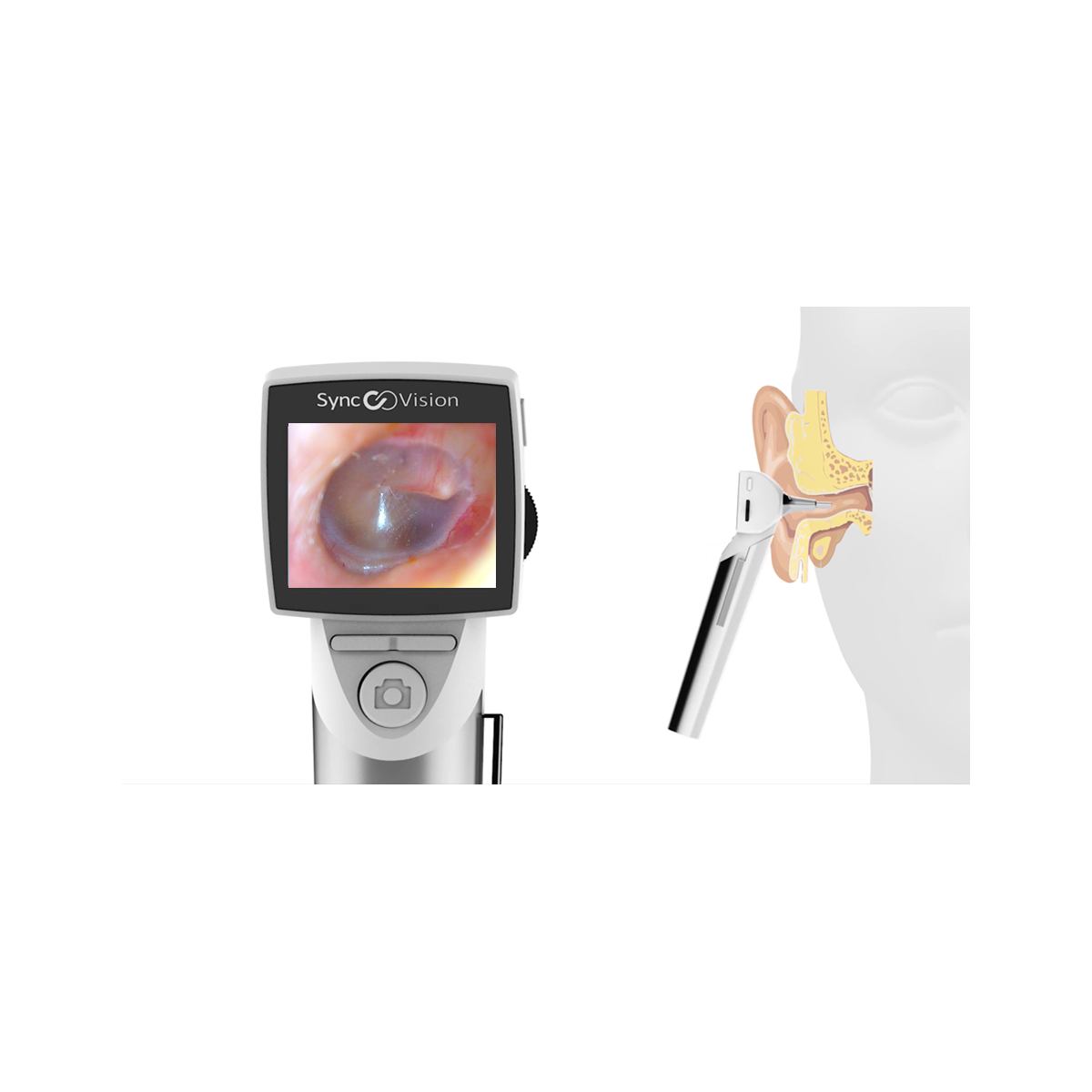 Otoscope digital avec écran, SyncVision iO1 Elite