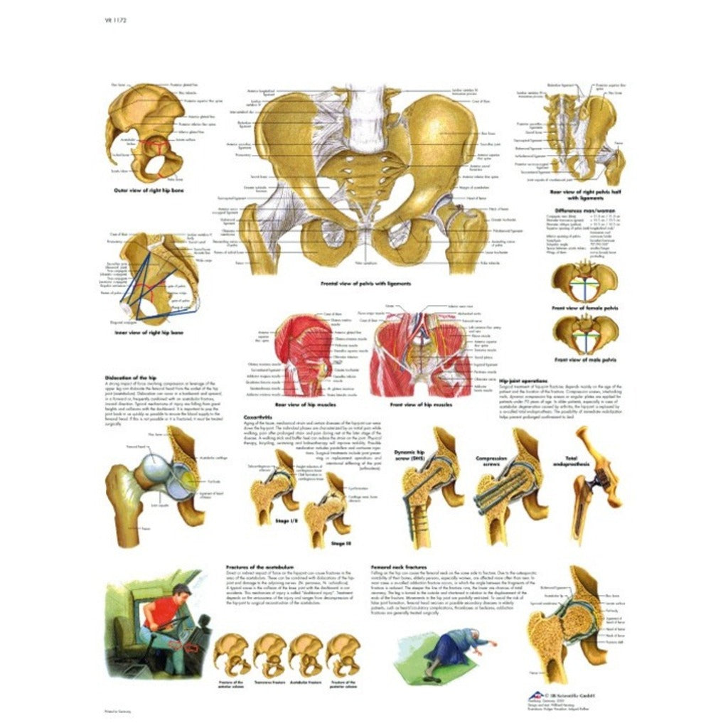 Planche anatomique - Hanche et bassin