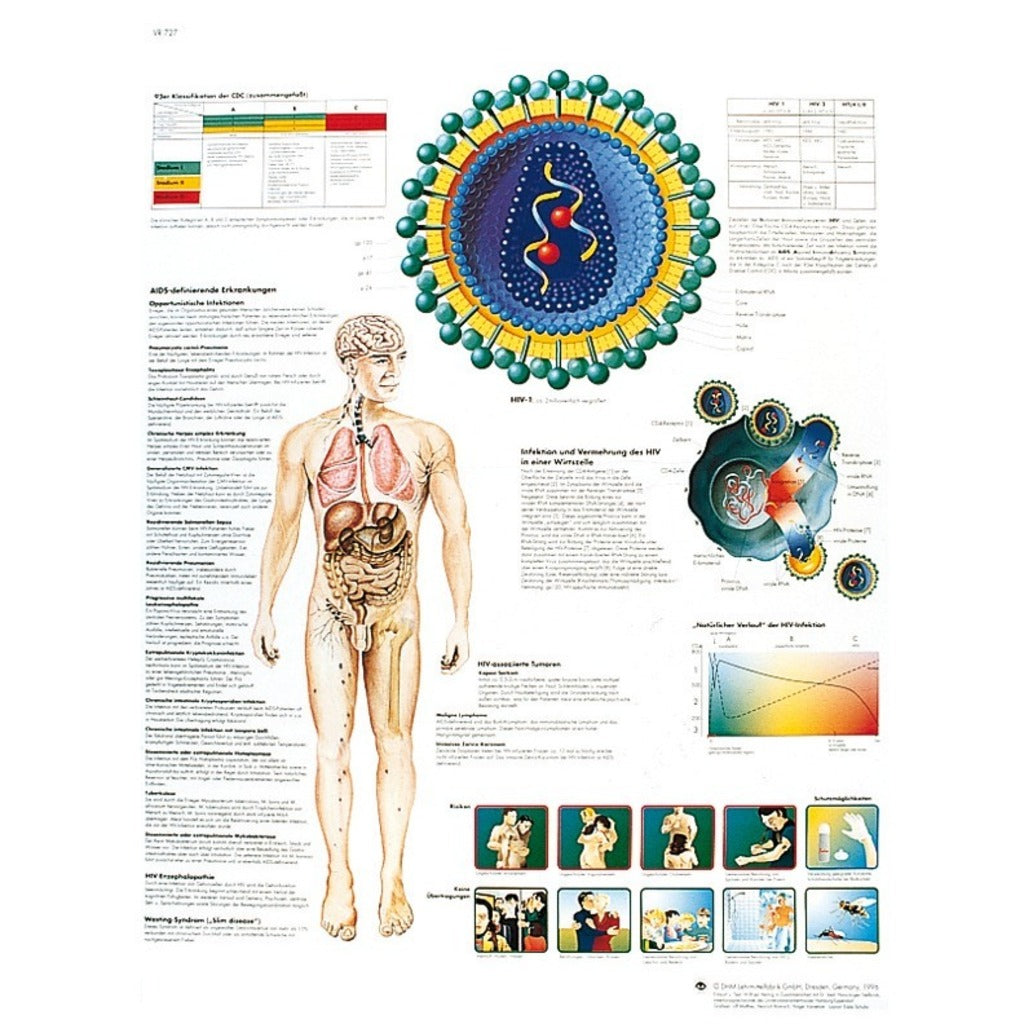 Planche anatomique - VIH & Sida