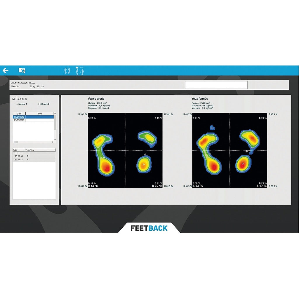 Plateforme de rééducation posturale Feetback