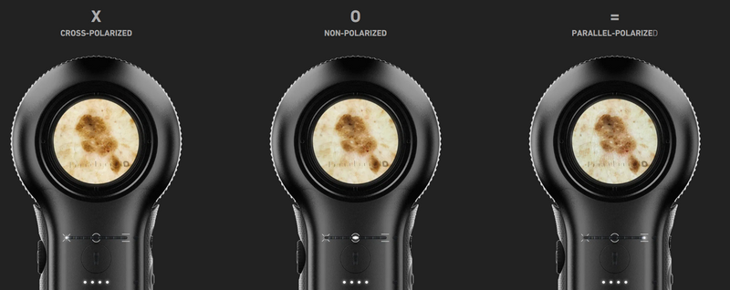 Dermatoscope DL5 - Dermlite