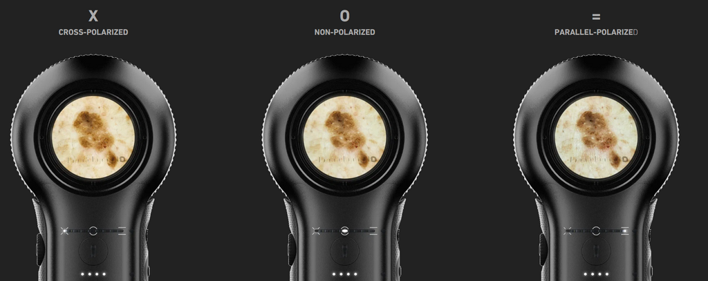 Dermatoscope DL5 - Dermlite