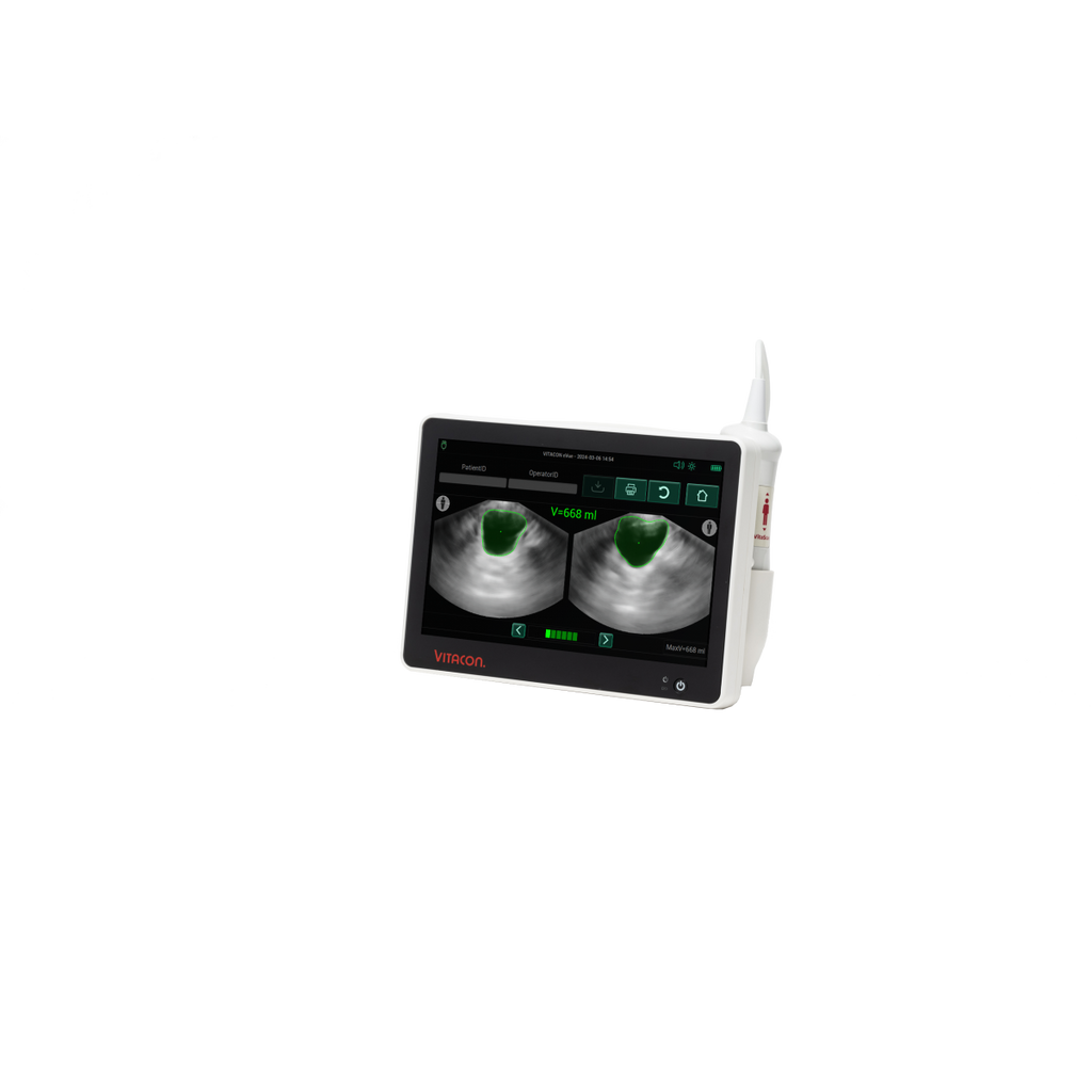 Bladder scanner VitaScan