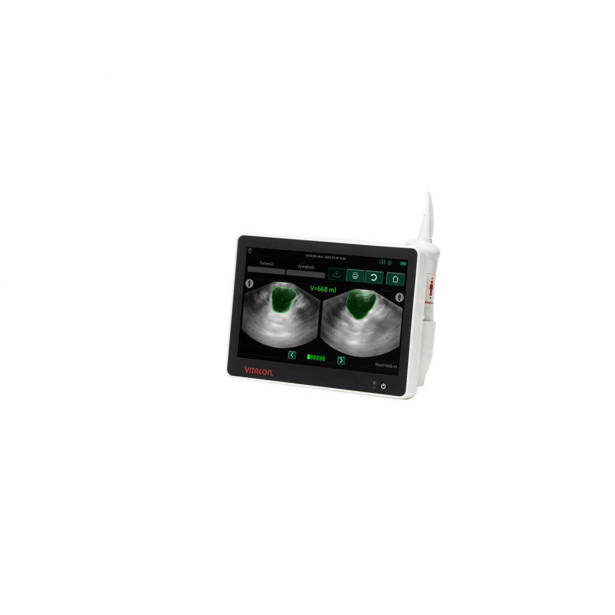 Bladder scanner VitaScan