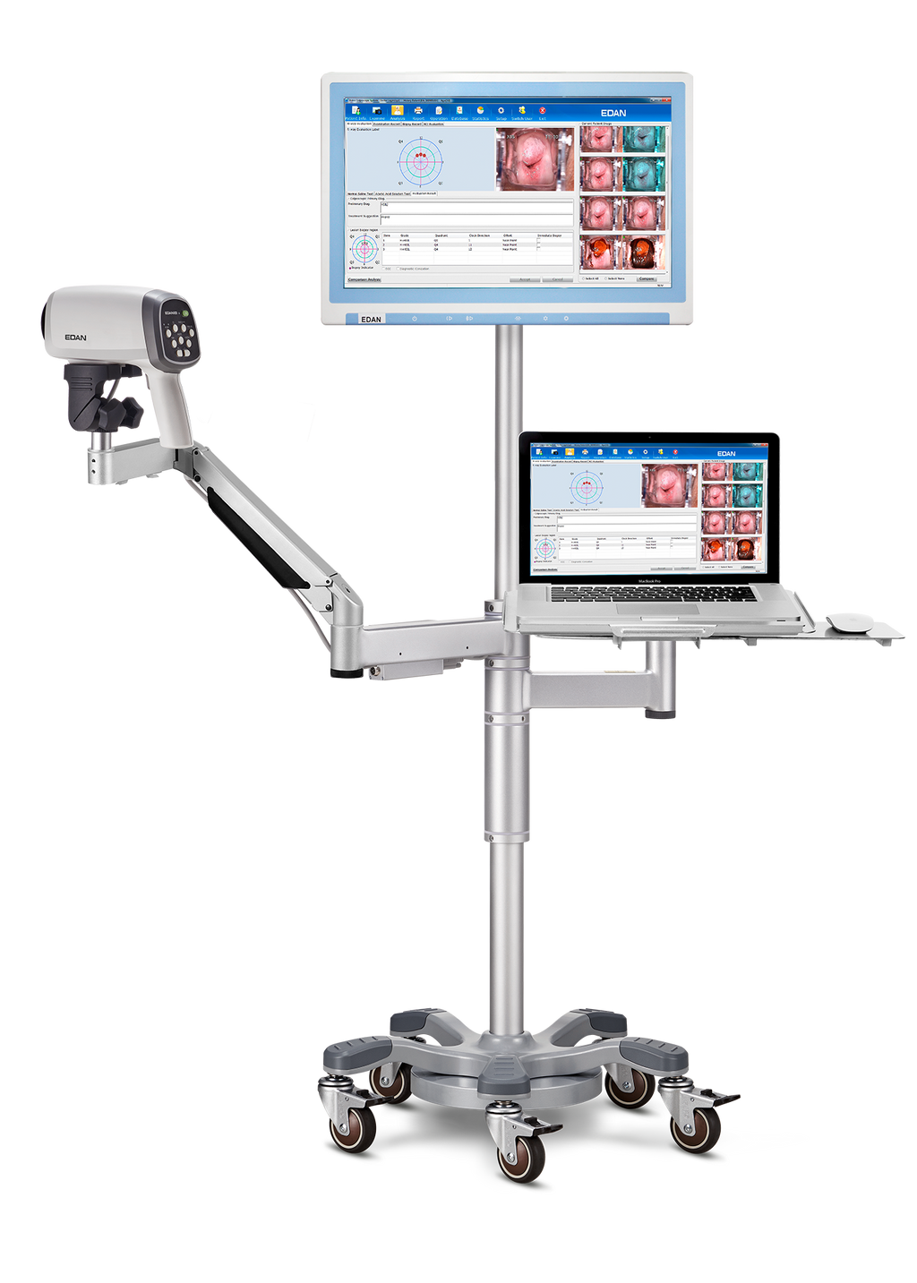 Videocolposcoop C6A-EDAN