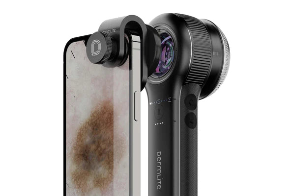 Dermatoscope DL5 - Dermlite