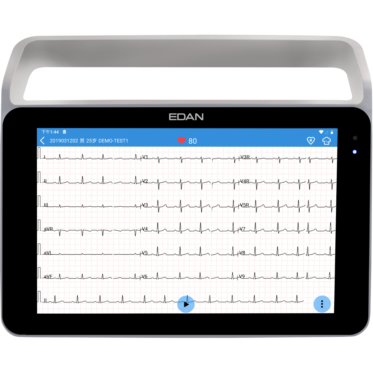 Tablette ECG EDAN ISE SE-1210