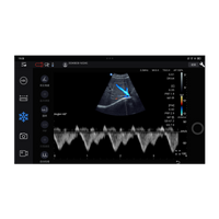 Echographe couleur portable Edan Nano convexe