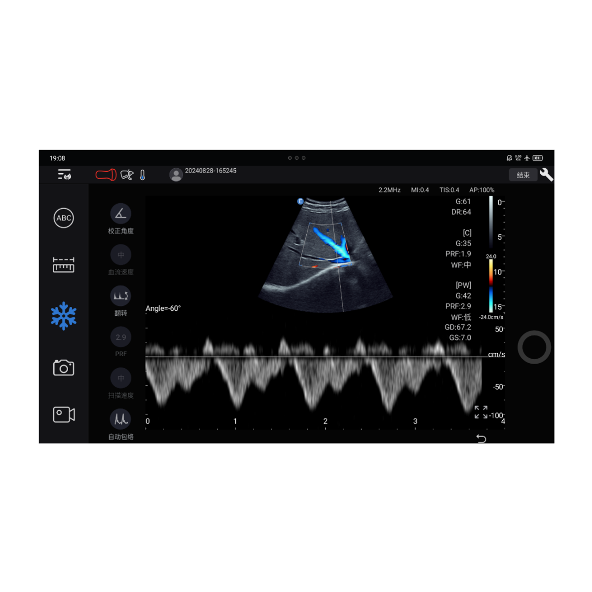 Echographe couleur portable Edan Nano convexe