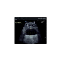 Echographe couleur portable Edan Nano convexe
