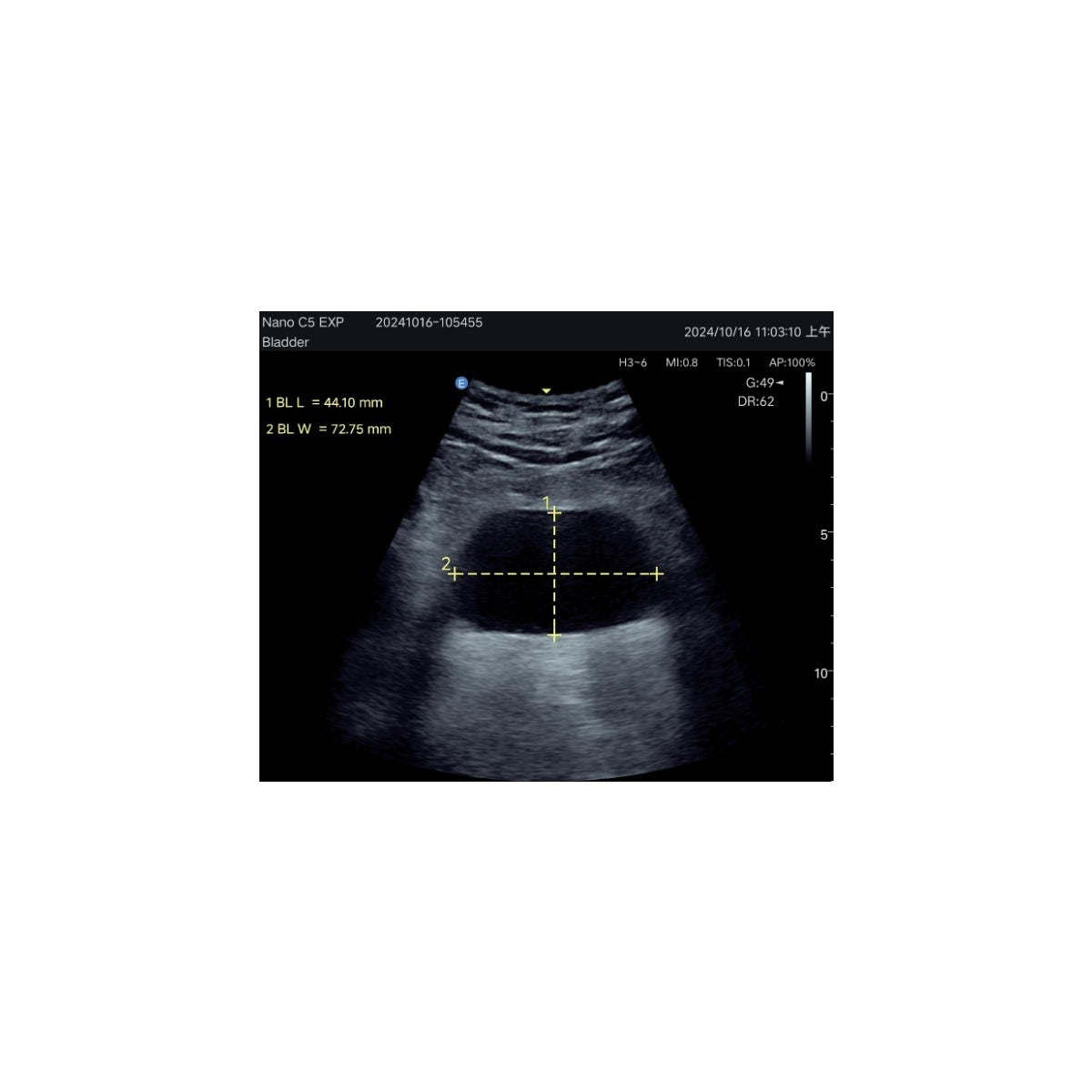 Echographe couleur portable Edan Nano convexe