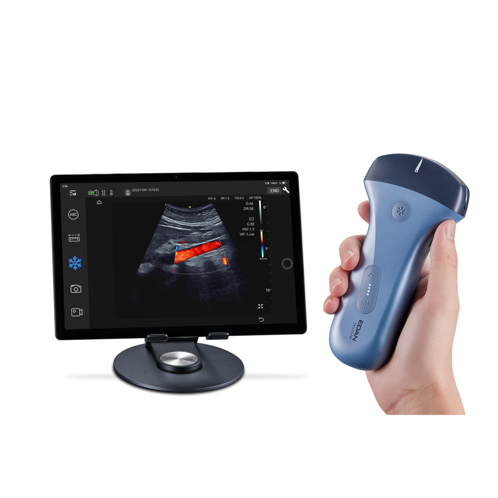Echographe couleur portable Edan Nano convexe