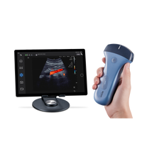 Echographe couleur portable Edan Nano convexe