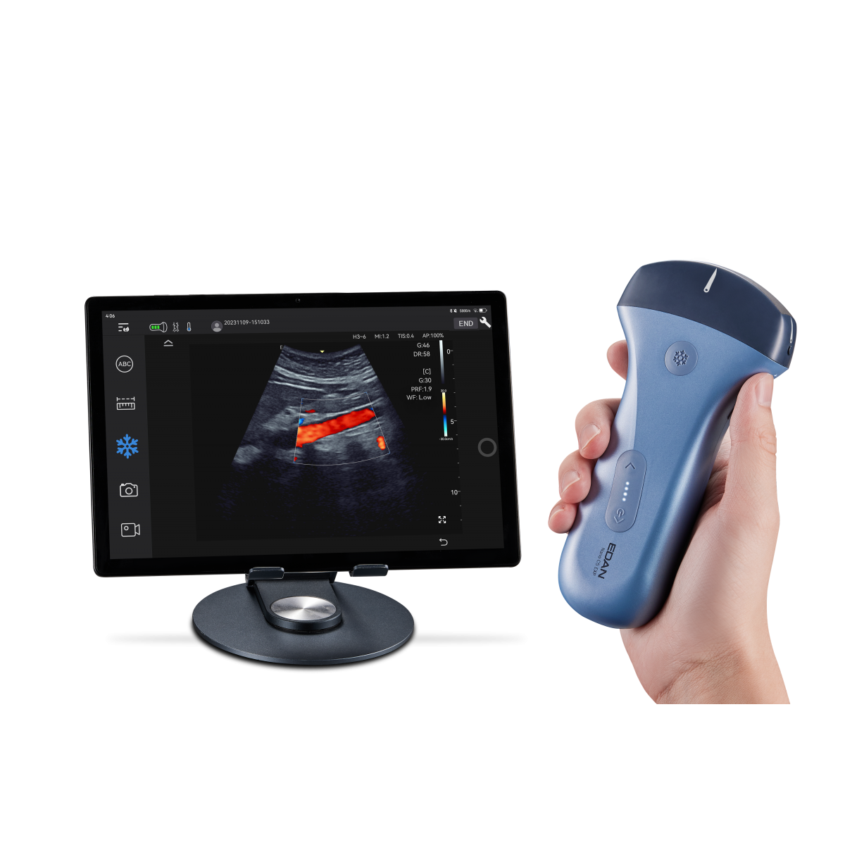 Echographe couleur portable Edan Nano convexe