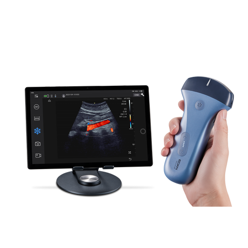 Echographe couleur portable Edan Nano convexe