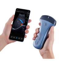 Echographe couleur portable Edan Nano convexe