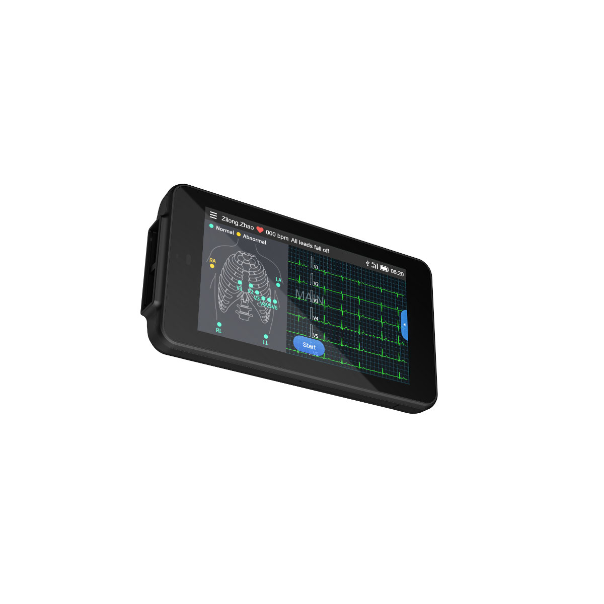 Tablette ECG de poche Cardio One Mini